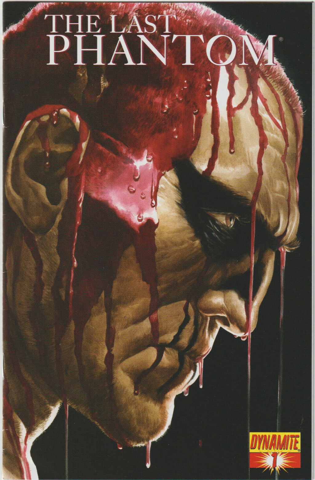 Image #1